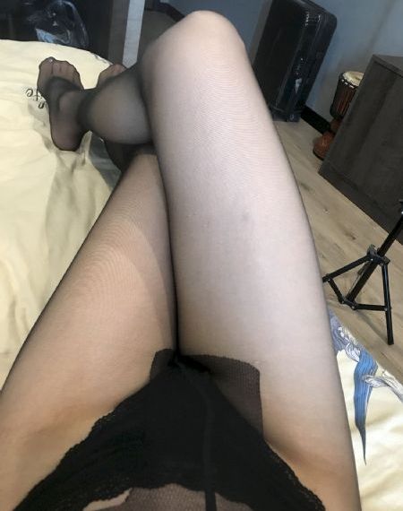 双眼皮整形手术